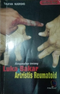 MENGUNGKAP TENTANG LUKA BAKAR & ARTRISTIS REUMATOID